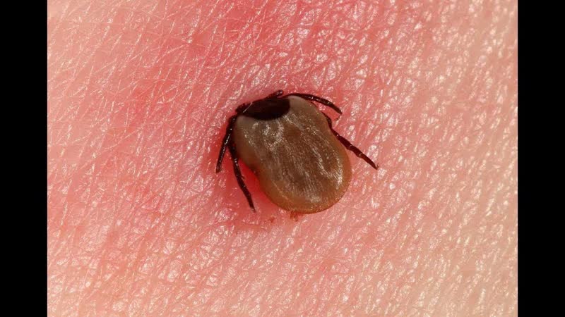 Lyme Disease Blocks Vitamin D Absorption by