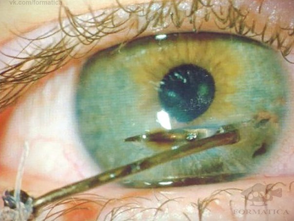 Рома Сухоносов, Россия, Ставрополь