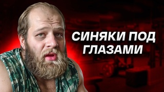 У Смаева Признаки Ишемической Болезни Сердца
